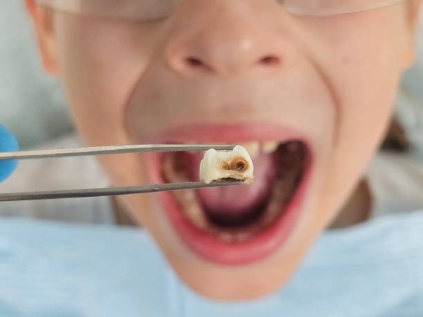 Best Weekend Emergency Dentist in Cape May, NJ